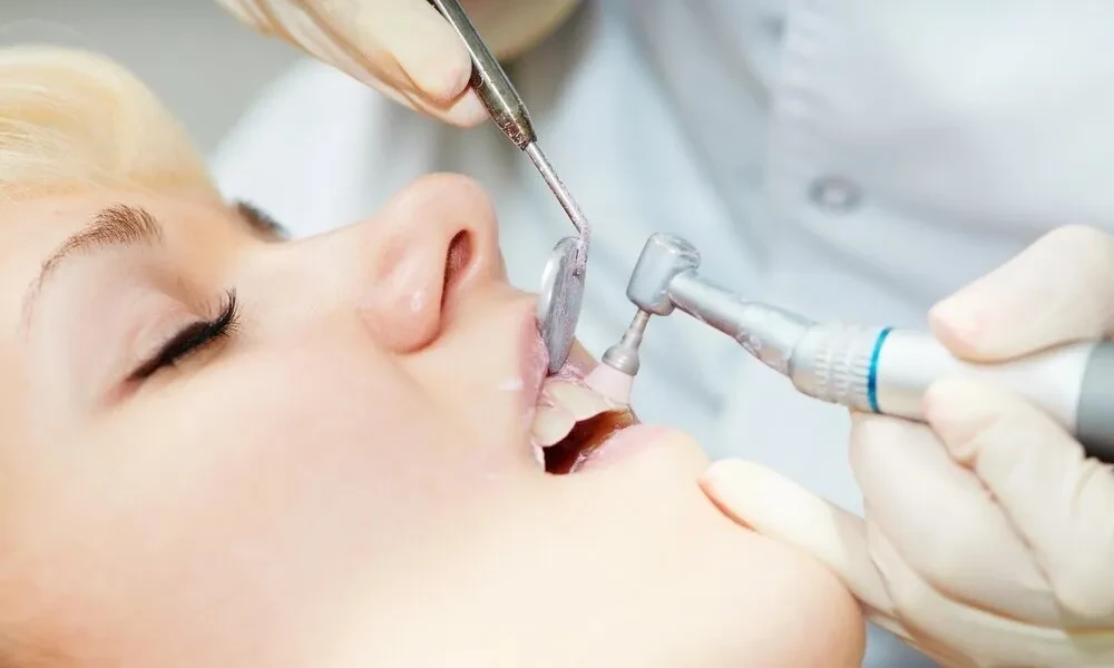 What to Expect Before and After All-on-4 Dental Implants